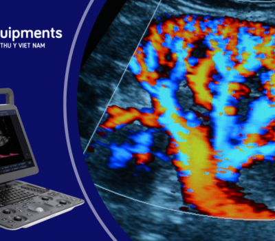 SIÊU ÂM MÀU DOPPLER – KỸ THUẬT SIÊU ÂM CÓ ĐỘ CHÍNH XÁC CAO NHẤT HIỆN NAY