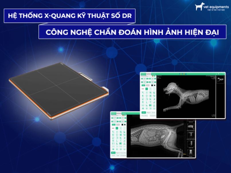 Tư vấn
