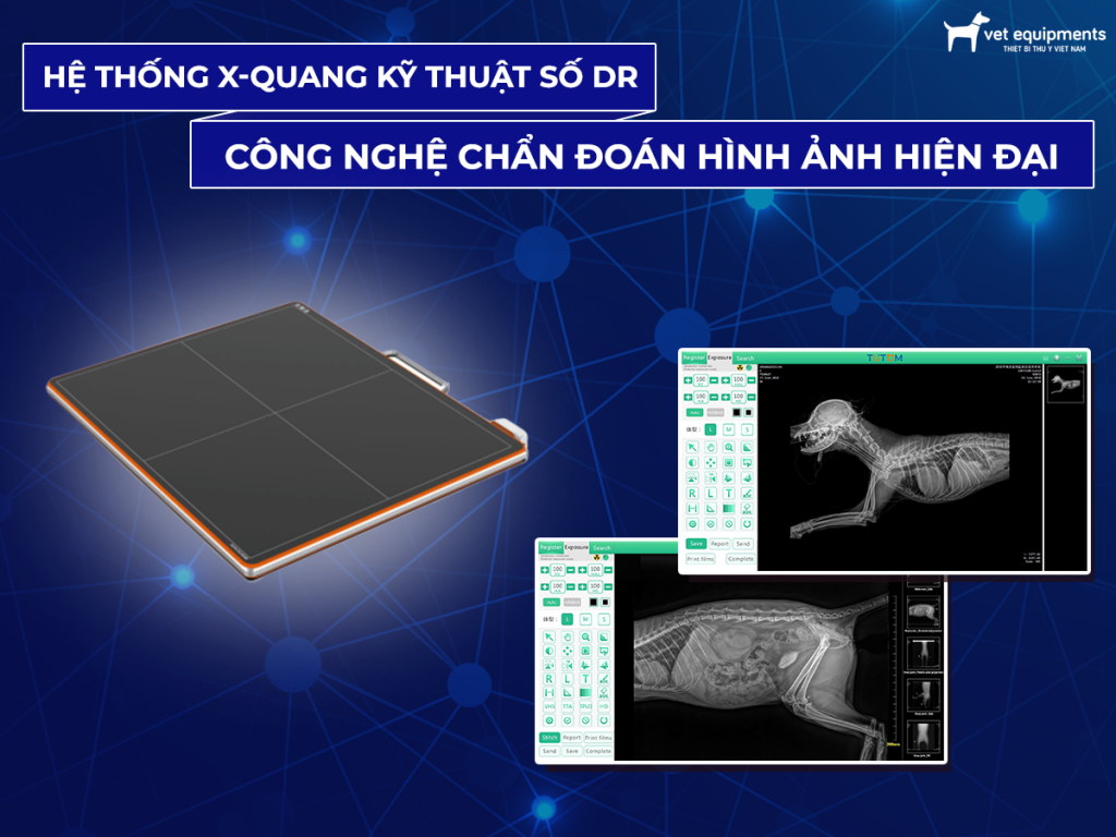Tư vấn