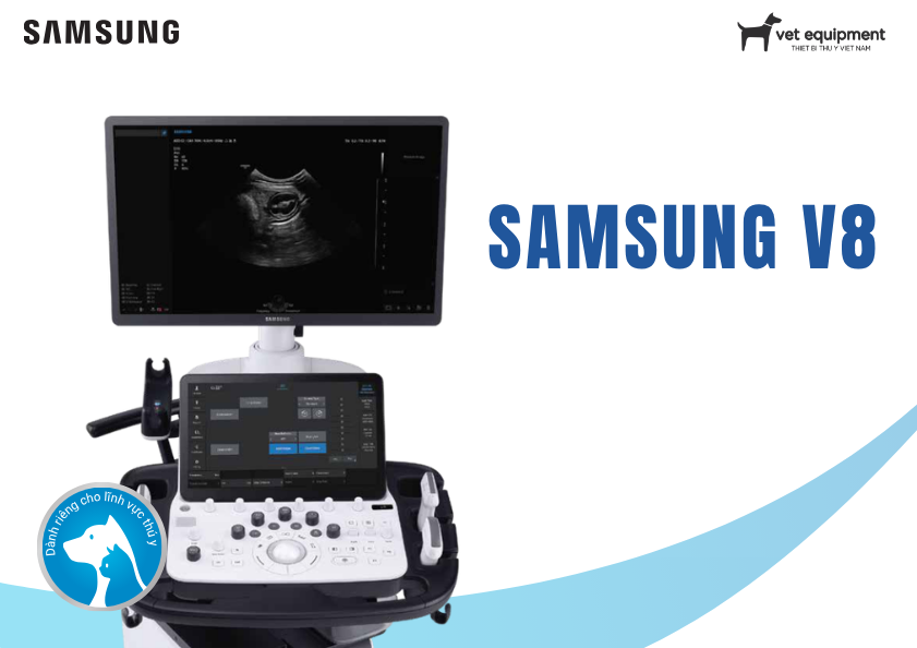 Siêu âm Samsung