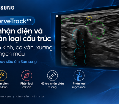 NerveTrack™ – Công nghệ AI trên siêu âm Samsung: hỗ trợ nhận diện thần kinh trên máy Siêu âm Samsung