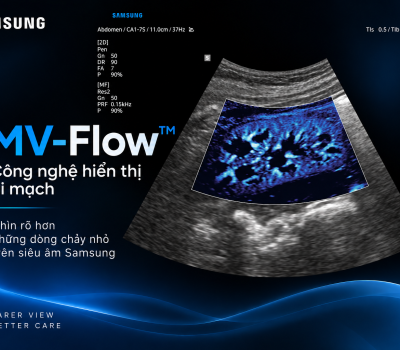 MV-Flow™ – Công nghệ hiển thị vi mạch trên máy siêu âm Samsung