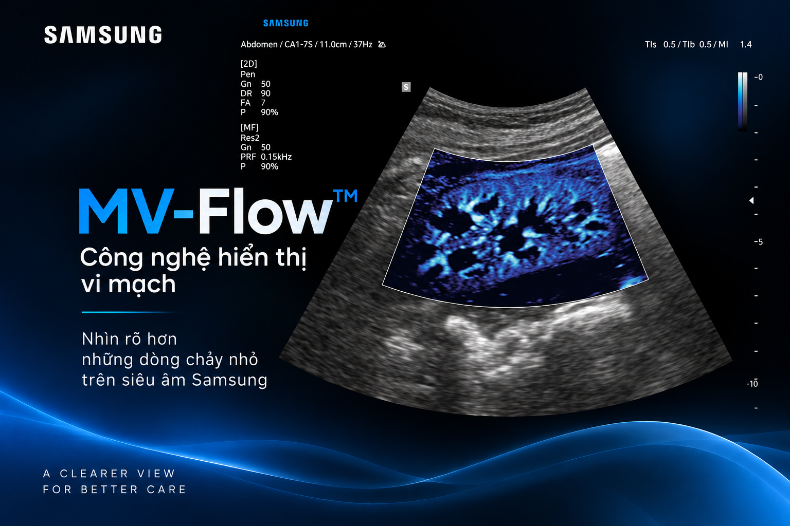MV-Flow™ – Công nghệ hiển thị vi mạch trên máy siêu âm Samsung